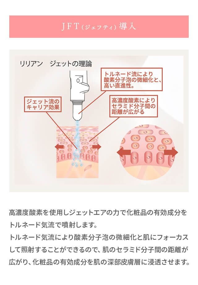 JFT（ジェフティ）導入